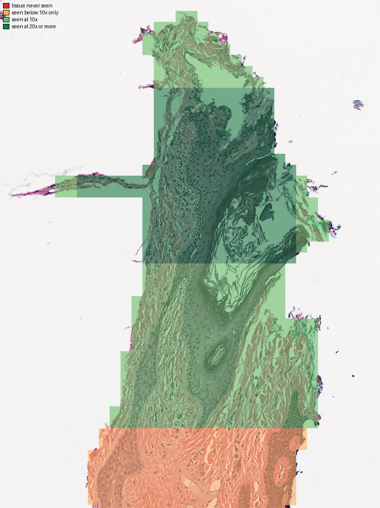 Coverage map of the same reading: tissue never seen in red, seen only below 10x in orange, seen at 10x in light green and at 20x in dark green.